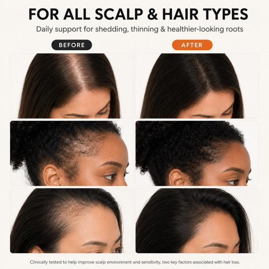 Koreas #1 Hair Growth Serum